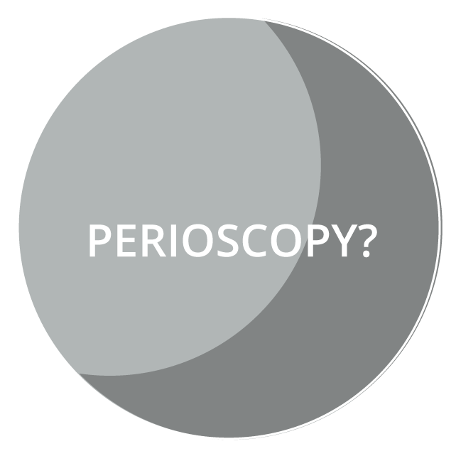 Perioscopy
